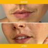 image:imageNads Facial Wax Strips  Natural All Skin Types  Waxing Kit With 30 Face Wax Strips amp Post Wax Oil 1 Count30 Count Pack of 1