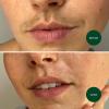 image:imageNads Facial Wax Strips  Hypoallergenic All Skin Types  Facial Hair Removal For Women  At Home Waxing Kit with 20 Face Wax Strips  4 Calming Oil Wipes  Skin Protection Powder25 Count Pack of 2