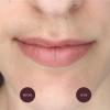 image:imageNads Gentle amp Soothing Facial Hair Removal For Women  Sensitive Depilatory Cream For Delicate Face Areas 099 Oz 4446099 Ounce Pack of 1
